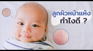 วิธีดูแลผิวเด็ก