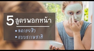 วิธีรักษาสิวแบบธรรมชาติ