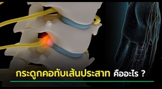 หมอนรองกระดูก