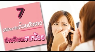 วิธีรักษาสิวแบบธรรมชาติ