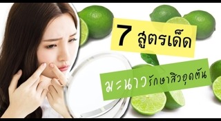 วิธีรักษาสิวแบบธรรมชาติ
