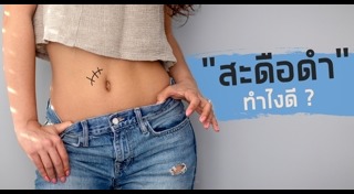 สะดือ
