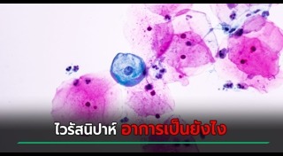 ไวรัสนิปาห์