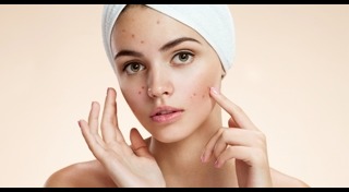 ครีมลดรอยสิว