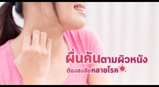 ผิวหนังบอกโรค