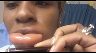 แพ้เครื่องสำอาง