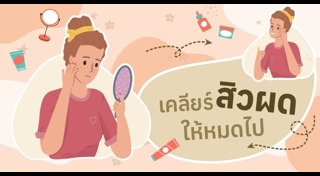 สิวผด