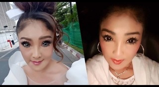 นักร้องลูกทุ่งศัลยกรรม