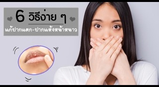ริมฝีปากแห้ง