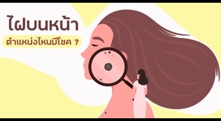 ดูดวงจากไฝ
