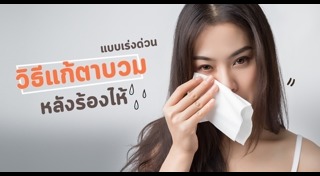 วิธีแก้ตาบวม