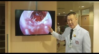 โรคไทรอยด์