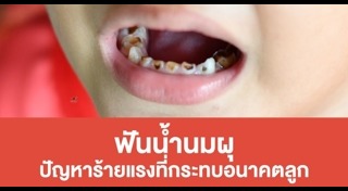 ฟันผุเสี่ยงโรค