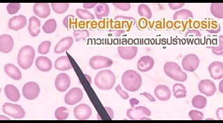 โรคทางพันธุกรรม