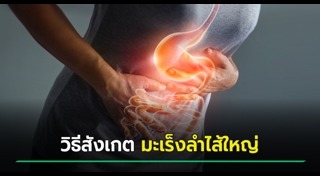 มะเร็งลำไส้