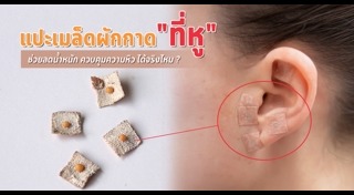 นวดกดจุด