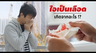 ไอเรื้อรัง