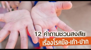 โรคมือเท้าปาก