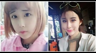 วิธีกำจัดขนบนใบหน้า