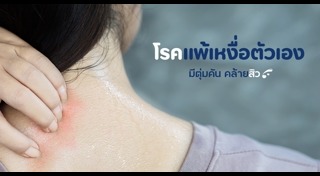 เหงื่อออกเยอะ