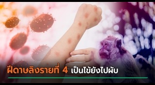 ฝีดาษลิง