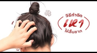 วิธีกำจัดเหา