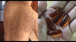 อาหารเสริมผิวขาว