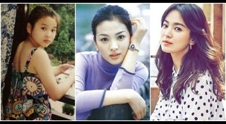 ดาราเกาหลีศัลยกรรม