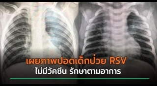 โรคเด็ก