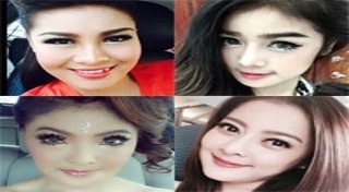 นักร้องลูกทุ่งศัลยกรรม