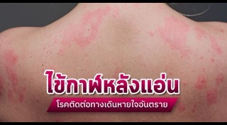 ไข้กาฬหลังแอ่น