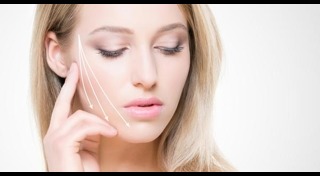 ร้อยไหม