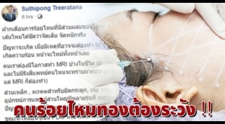 ร้อยไหม