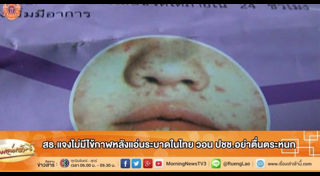 ไข้กาฬหลังแอ่น