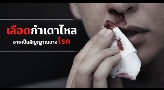 วิธีห้ามเลือด