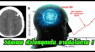 งานวิจัยสุขภาพ