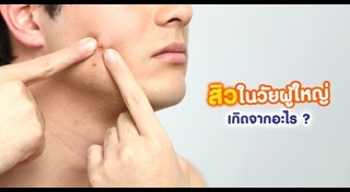 ปัญหาผิวหน้า