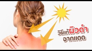 ผิวเสีย