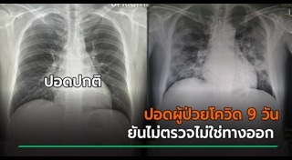 ปอดติดเชื้อ