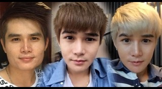 ศัลยกรรมชาย