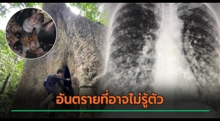 ปอดติดเชื้อ