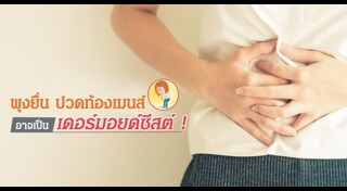 ซีสต์