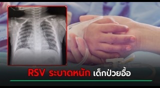 ไวรัส RSV