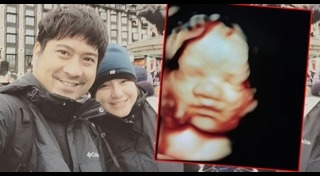 หนุ่ม อรรถพร