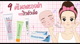 ครีมลดรอยสิว