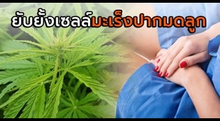 มะเร็งปากมดลูก