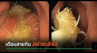 พยาธิ