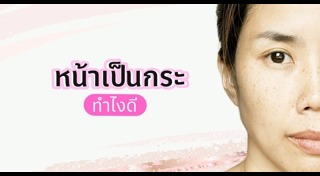 จุดด่างดำ