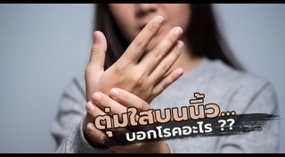อาการแพ้