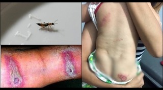 แมลงมีพิษ